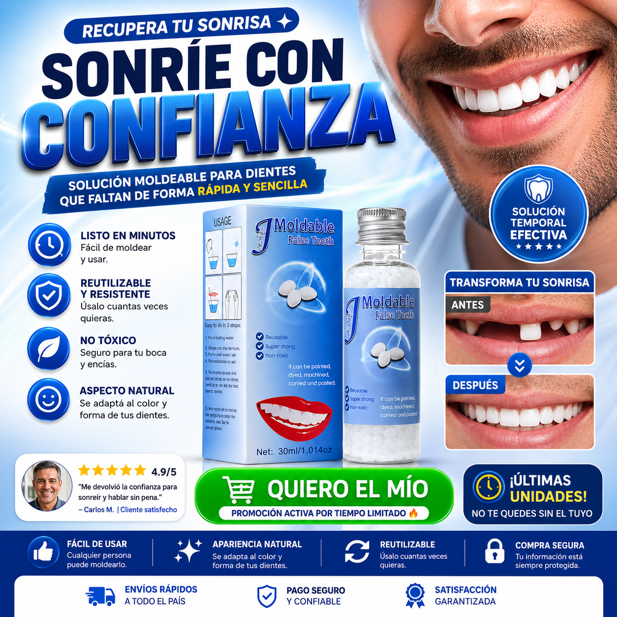 💎 Resina Dental: Solución Rápida para una Sonrisa Natural